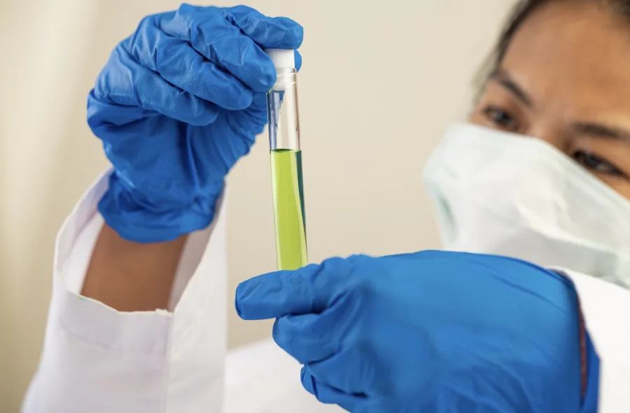 Teste toxicológico para tirar a CNH: quais substancias são detectadas?