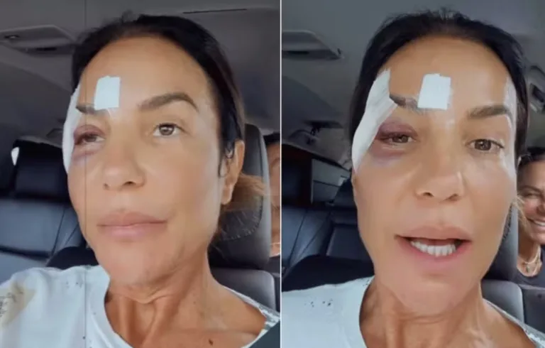 O que aconteceu com Ivete Sangalo? Cantora recebe alta: o que aconteceu com a famosa e qual é o estado de saúde dela