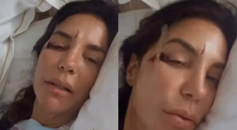 Ivete Sangalo desmaia após infecção intestinal e é internada em Salvador; entenda o que aconteceu