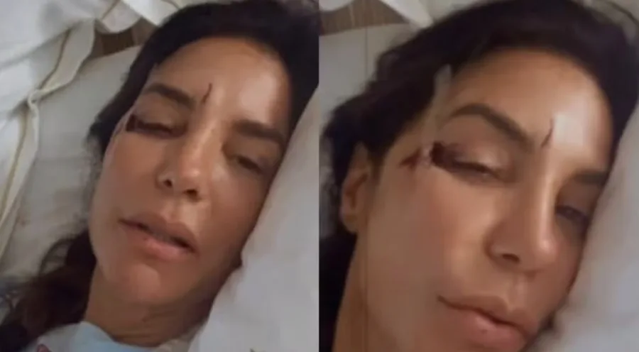 Ivete Sangalo desmaia após infecção intestinal e é internada em Salvador; entenda o que aconteceu