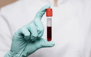 Transfusão de Sangue: testemunha de jeová agora tem novas regras; veja como funcionará