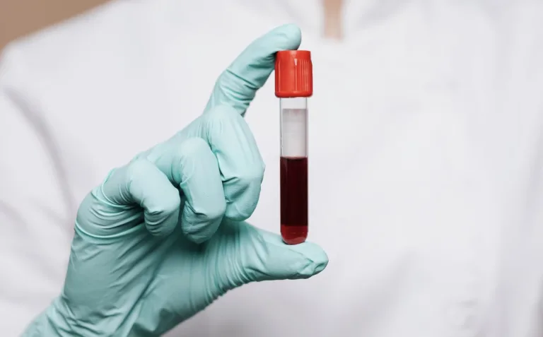 Transfusão de Sangue: testemunha de jeová agora tem novas regras; veja como funcionará