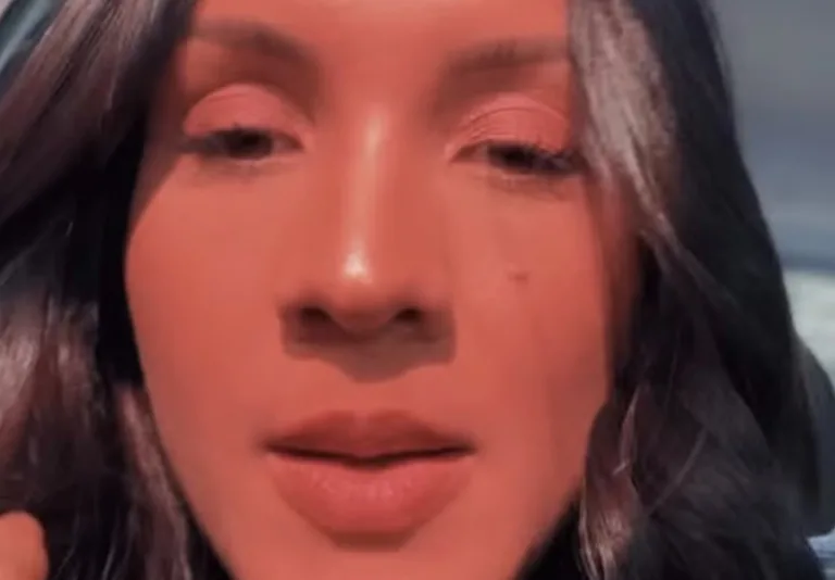 Maxiane comentou nas redes sobre os sinais no rosto, disse que não pretende removê-los e afirmou que fazem parte da sua identidade após o BBB 26