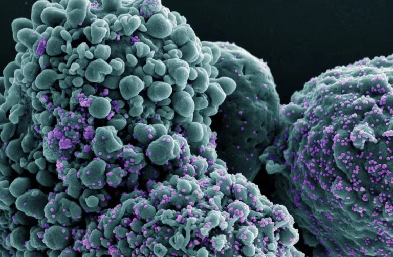 Nova Covid-19? variante BA.3.2 pode aumentar afastamentos e pressionar empresas mesmo sem casos graves