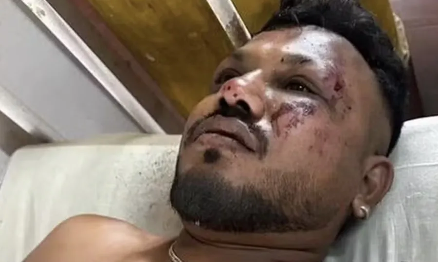 Único sobrevivente de queda de avião da Air India vive isolado e assombrado pelos mortos