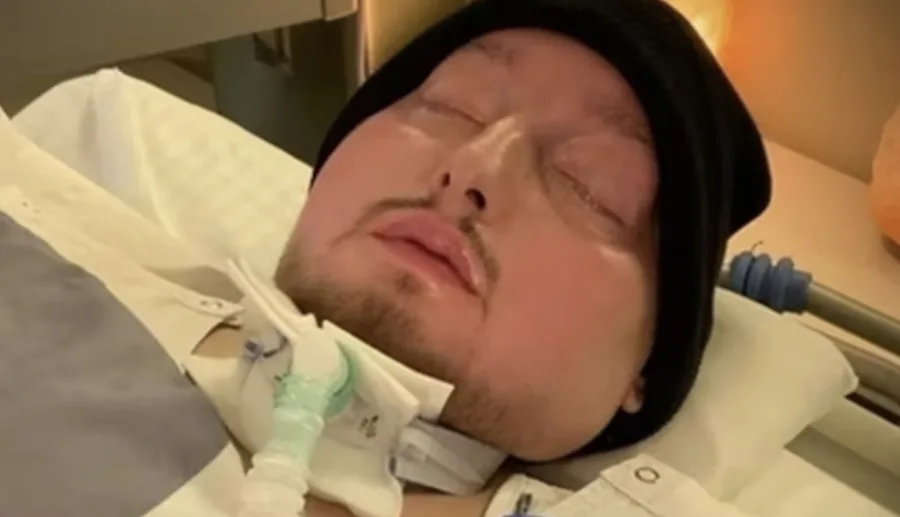 O “príncipe adormecido” que passou metade da vida em coma finalmente morreu aos 36 anos